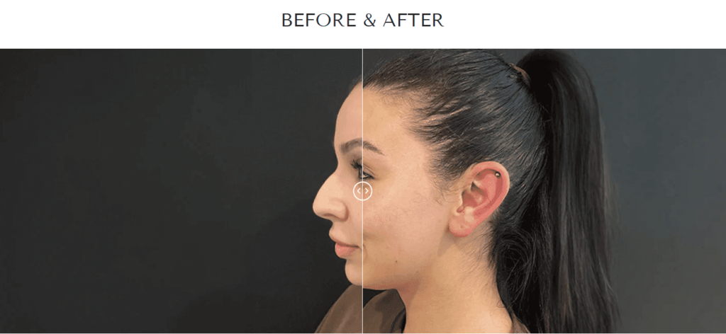 flawless-before-after-image